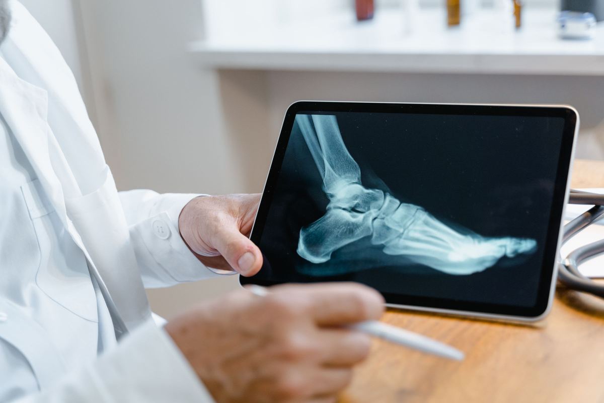 Physician reviewing a foot X-ray on a tablet
